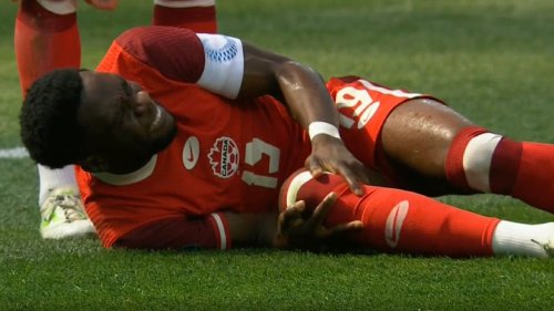 „Mein ganzes Bein war ...“: Bayern-Star Davies verrät Details über Horror-Verletzung
