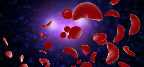 With Rare Acquisition Novo Nordisk Makes 1B Bet On Sickle Cell 