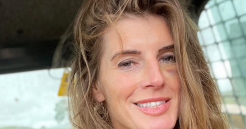 Our Yorkshire Farm fans rush to support Amanda Owen after she posts photo of black eye
