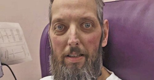 Dad dies from stage four cancer days after sharing strange symptom on skin