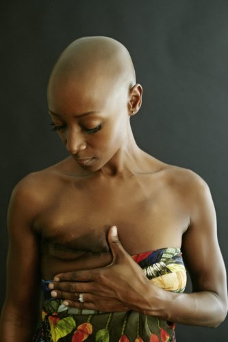 Loving Your Body After a Mastectomy