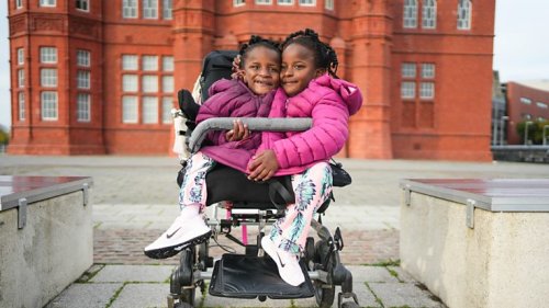 New Documentary Explores The Miraculous Journey Of Conjoined Twins From Senegal