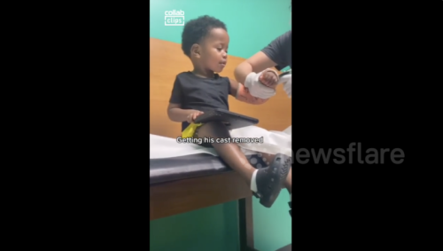 Adorable Video Shows Toddler's Reaction To Getting His Cast Removed