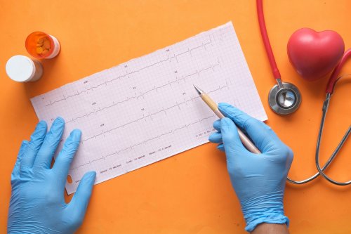 Black People Are High-Risk For Heart Disease – What To Know About Prevention And Treatment - Blavity