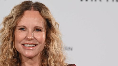 Katja Burkard ist nicht allein: Diese Stars stehen zu ihren Schönheitseingriffen