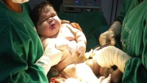 Rekord-Baby in Brasilien: Kind kommt mit sieben Kilogramm zur Welt