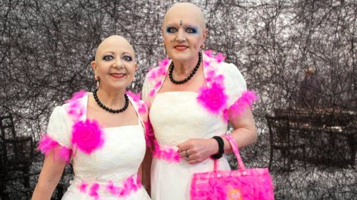 Nach OP an Lendenwirbelsäule: Eva vom Künstler-Paar Eva & Adele ist gestorben