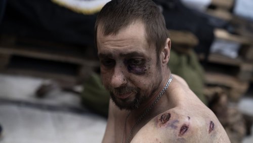 Trump a raison, la guerre en Ukraine est une boucherie