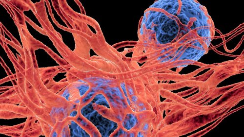 Wichtig für Therapien: Zürcher Studie zeigt, wie Krebszellen auf Stress reagieren
