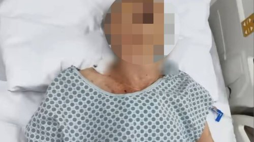 Skurriler Fall aus Brasilien: Totgeglaubte Frau erstickt fast im Leichensack – und stirbt dann wirklich