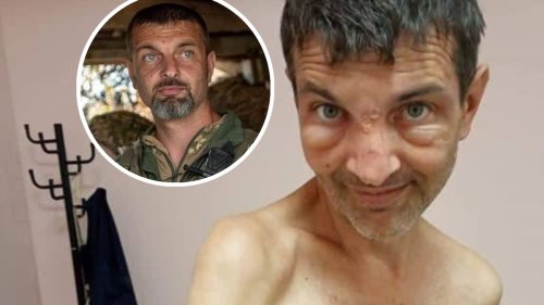 Cet Ukrainien a perdu 40 kilos en quatre mois: «Les Russes nous ont traités comme des animaux en prison»