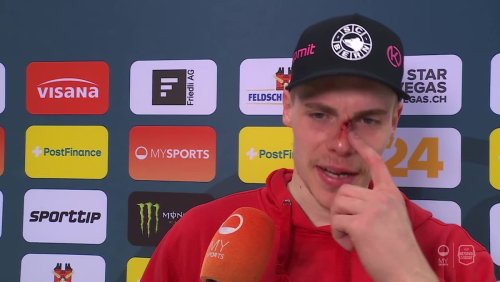 SCB-Siegtorschütze Merelä erklärt: «Musste schnell die Nase nähen lassen»