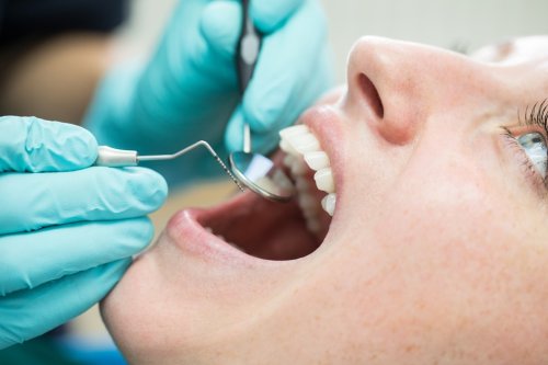 Was nützt eine professionelle Zahnreinigung wirklich?