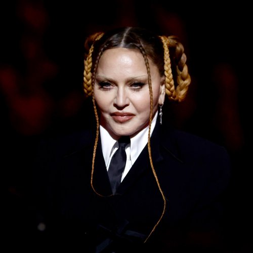 “The Worst Thing That I Ever Did”: 19 Celebrities Before And After Plastic Surgery