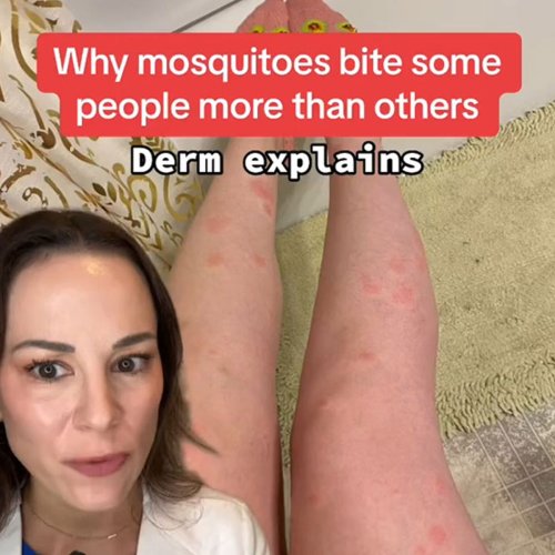 Dermatologist Explains What People Are ‘Mosquito Magnets’ And How To Avoid The Annoying Bugs