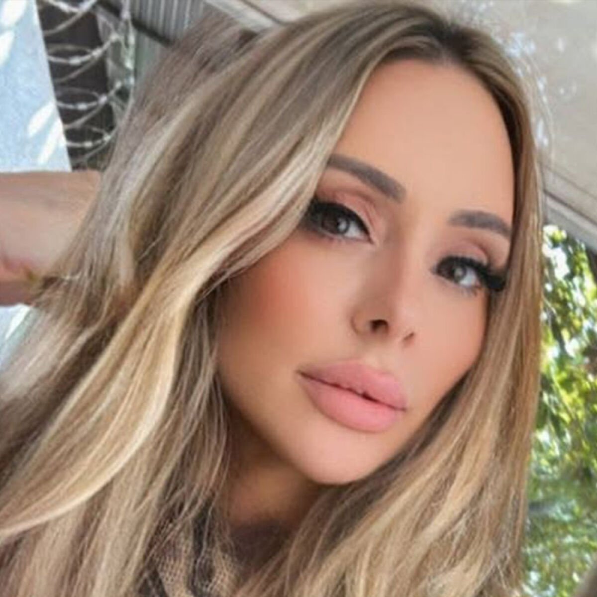 Woman Loses Life After Undergoing 6 Cosmetic Procedures At Once She’d Saved For Years To Afford
