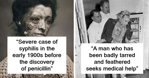 “History Everyday”: 25 Interesting Historical Pictures That Might Teach You Something New