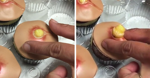 Pimple Cupcakes With Squeezable Heads Are A Thing Now (Unfortunately)