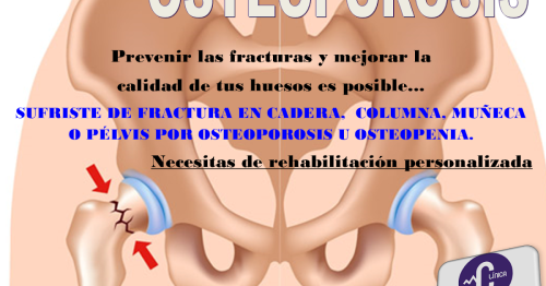Rehabilitación en la osteoporosis: Clínica de Rehabilitación Física la Barca Jalisco.