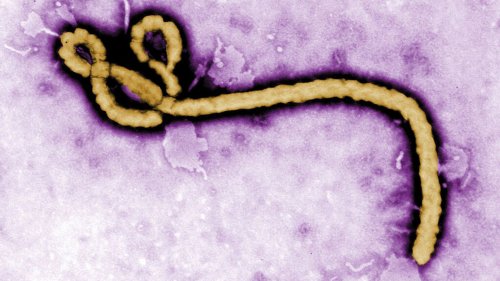 Großeinsatz wegen Ebola-Verdachtsfall in Tschechien
