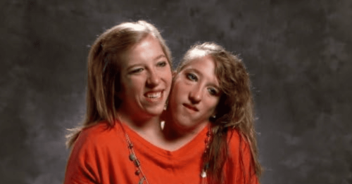 Conjoined Twin Abby Hensel of “Abby & Brittany” Is Married!