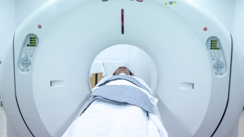 Study highlights cancer risk from millions of CT scans performed annually