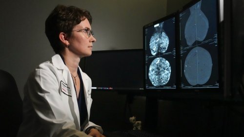 Diagnosed with 'dense breasts'? You may need more than a mammogram