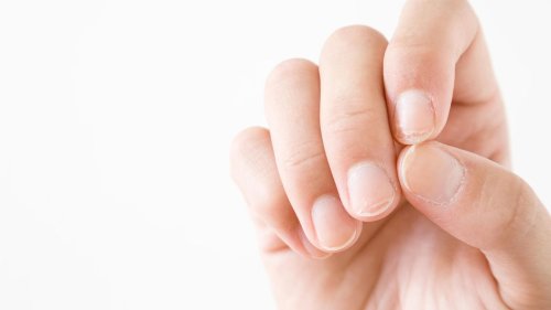 Gelbe Fingernägel: Welche Hausmittel bei Verfärbungen helfen können