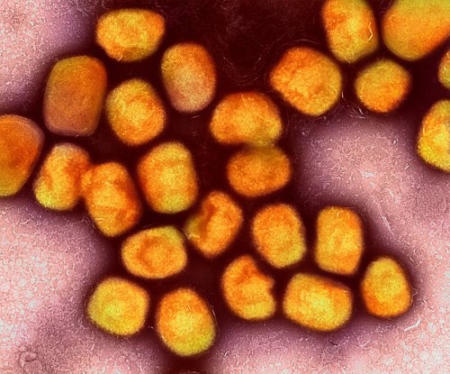 First case of monkeypox confirmed in Minnesota