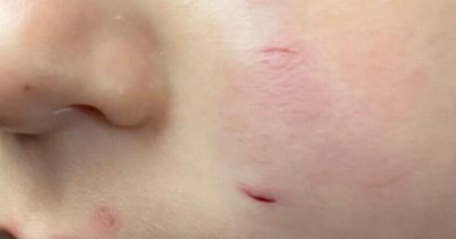 Mum's own 'horror film' as rat attacks toddler's face in bed