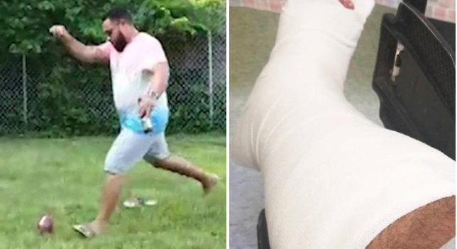 Dad-To-Be Ends Up In Leg Cast Following A Disastrous Gender Reveal