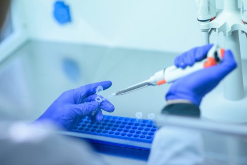 Donald Trump will Medikamenten-Preise in den USA senken – so reagieren die Pharma-Aktien auf dieses Vorhaben