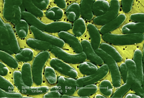 Klimawandel lässt Bakterien nach Norden wandern und verursacht "fleischfressende" Infektionen