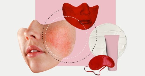 Struggling With Rosacea? Here’s What The Pros Wish You Knew