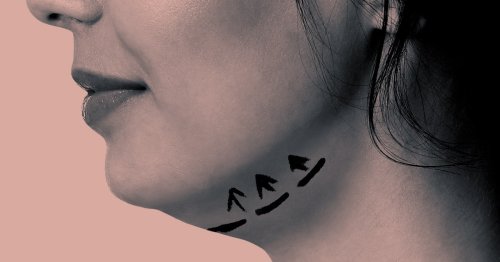 Your Comprehensive Jawline-Sculpting Treatment Guide