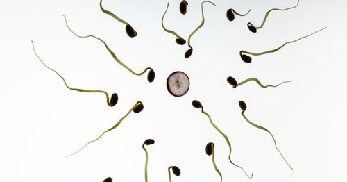 Dwindling Sperm Counts Have Impacts Beyond Male Fertility