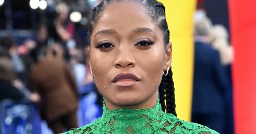 I'm Sorry To Keke Palmer, But Adult Acne Cannot Be Cured Using Butt Skin
