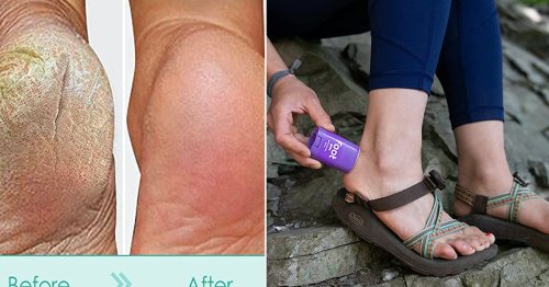 Your Feet Could Feel, Look, & Smell So Much Better With Any Of These Clever Things