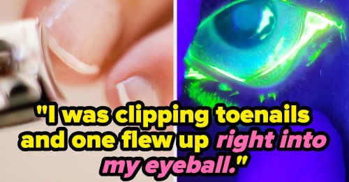 "A Marshmallow Tore My Cornea" — 28 Of The Absolute Dumbest Ways People Have Ever Gotten Injured