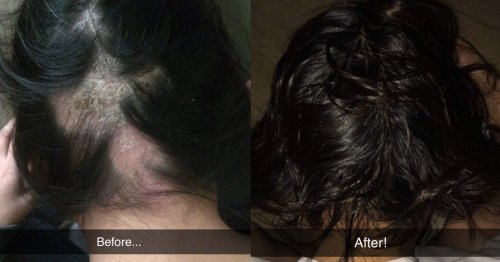 36 Incredibly Easy Ways To Get The Healthiest Hair Of Your Life