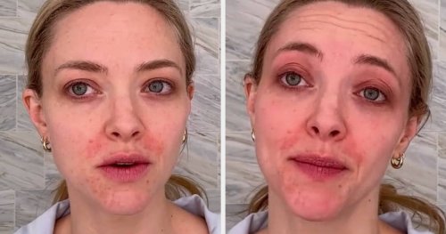 Amanda Seyfried Is Being Praised For Her “Honesty” And “Vulnerability” After She Showed Off Her Natural Skin On TikTok