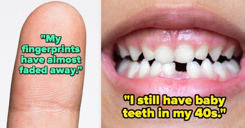 29 People Opened Up About The "Weirdest" Parts Of Their Bodies, And I'm Completely Intrigued