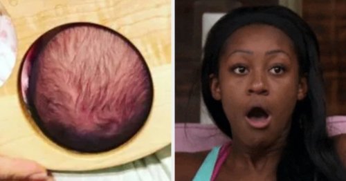 This Viral Photo Shows How Big A Woman's Cervix Gets When It's Fully Dilated During Childbirth