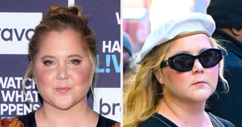 Amy Schumer Revealed Her Cushing Syndrome Diagnosis After Criticism Towards Her Facial Appearance
