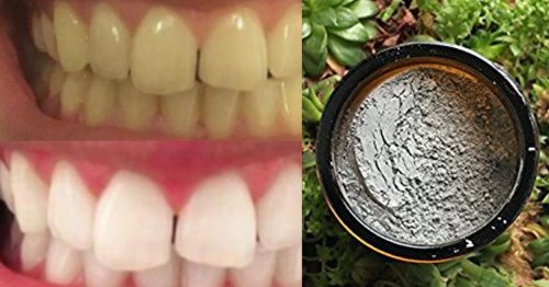 14 Teeth Whiteners That Work So Well, It's Like Magic