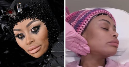 Blac Chyna Dissolves Face Filler And Results Are Dramatic