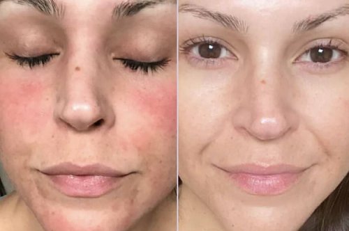 30 Products With Before And Afters That May Look Like They're Photoshopped, But They’re The Real Deal