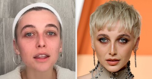 A Stranger In A Hair Salon Diagnosed Emma Chamberlain With PCOS After Noticing This Specific Thing About Her Appearance — Here's How It Wound Up Changing Her Life