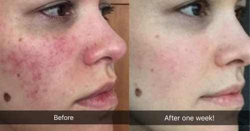 24 Things That Will Make Your Skin Clearer Than It's Ever Been