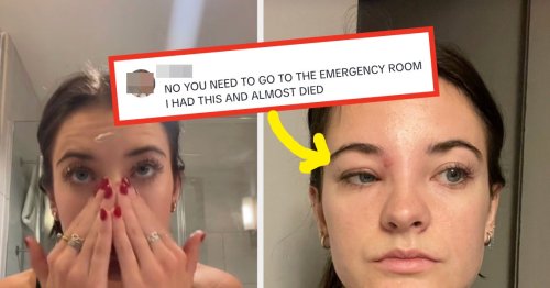 This "Dance Moms" Star Just Warned Millions About The Dangers Of Popping Pimples In The "Triangle Of Death," And It's Alarming
